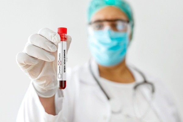 Região volta registrar novos casos de varíola dos macacos, aponta boletim