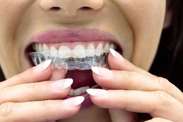 Bruxismo é provocado pelo estresse crônico e afeta 30% de pessoas na RMC