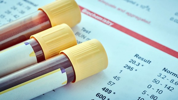 Monte Mor inicia mutirão para zerar fila de exames laboratoriais na rede pública